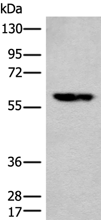 Rabbit Polyclonal Antibody to CES2