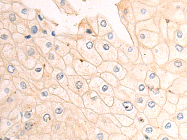 Rabbit Polyclonal Antibody to CHM