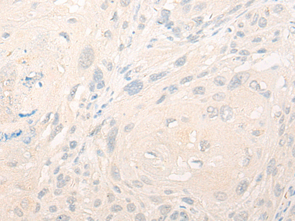 Rabbit Polyclonal Antibody to TNFSF11