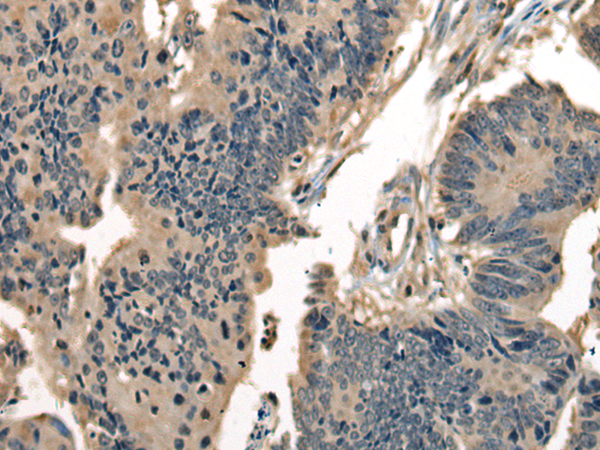 Rabbit Polyclonal Antibody to DNAJC2