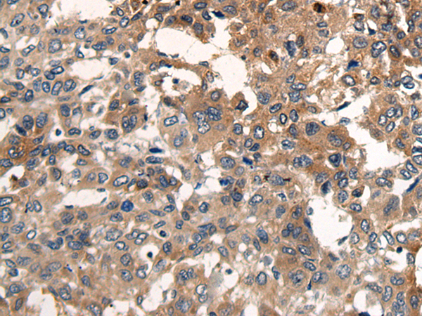 Rabbit Polyclonal Antibody to CDH17