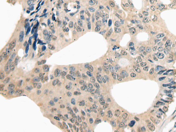 Rabbit Polyclonal Antibody to ETV4