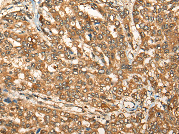 Rabbit Polyclonal Antibody to ALK