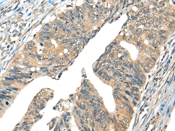 Rabbit Polyclonal Antibody to AIFM2