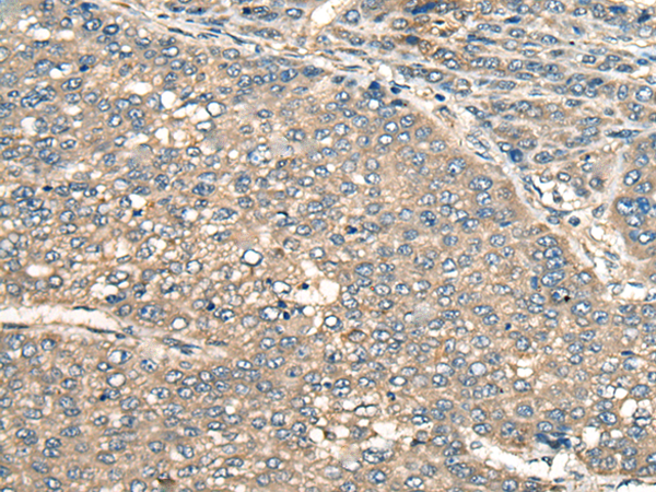 Rabbit Polyclonal Antibody to PIAS3