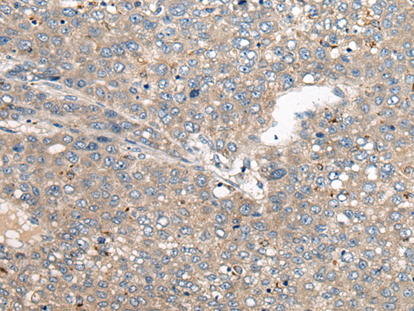 Rabbit Polyclonal Antibody to NRG2