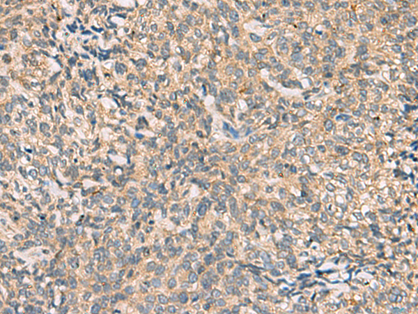 Rabbit Polyclonal Antibody to CMTM4