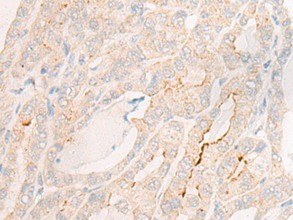Rabbit Polyclonal Antibody to IGSF3
