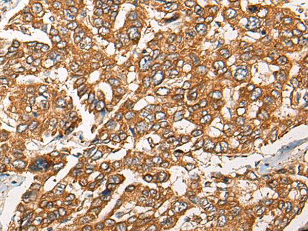 Rabbit Polyclonal Antibody to HCRT(Orexin-B)