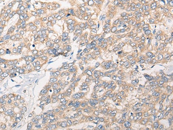 Rabbit Polyclonal Antibody to REM1
