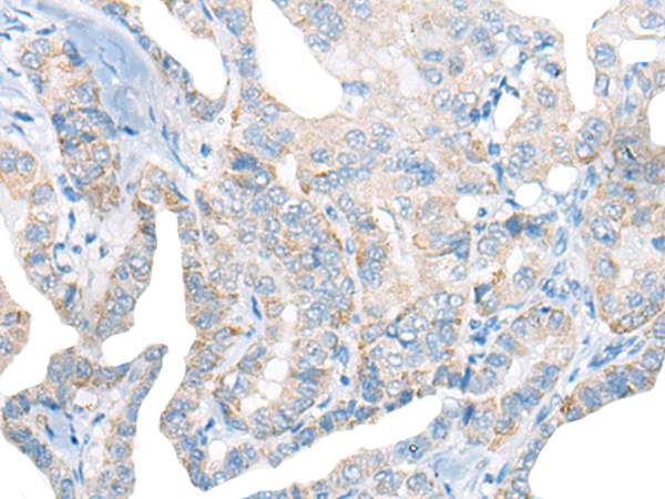 Rabbit Polyclonal Antibody to CCL11