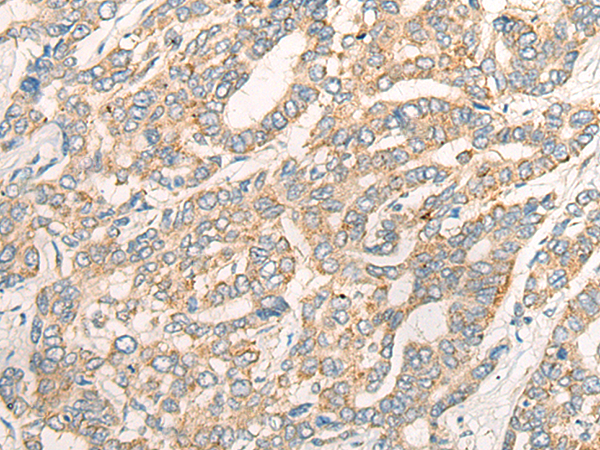Rabbit Polyclonal Antibody to CCL16