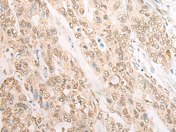 Rabbit Polyclonal Antibody to CDX4