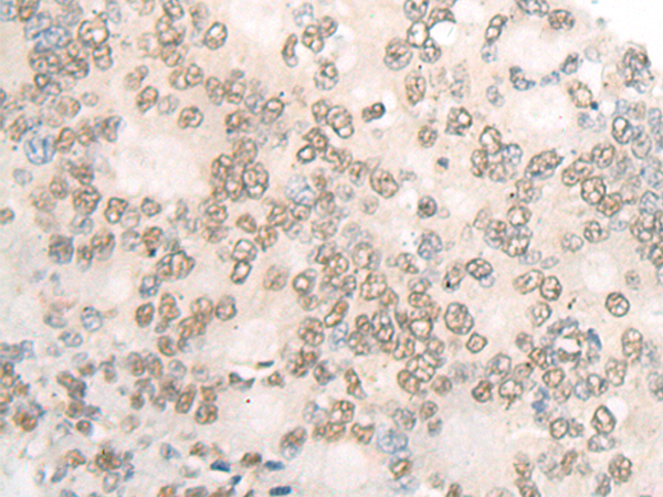 Rabbit Polyclonal Antibody to DR1