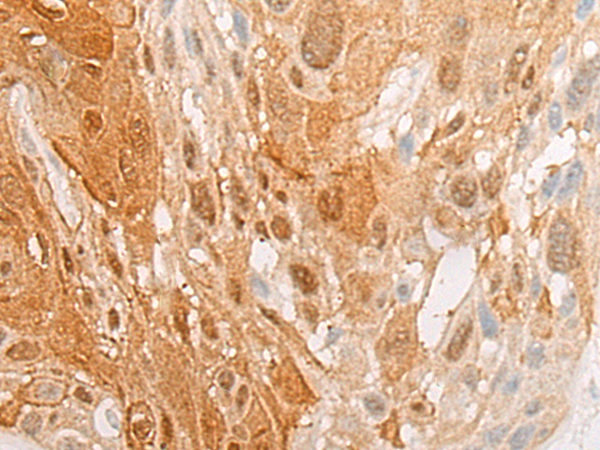 Rabbit Polyclonal Antibody to ERCC1