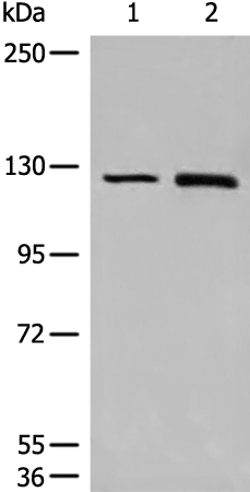Rabbit Polyclonal Antibody to CLIP2