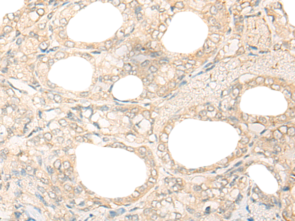 Rabbit Polyclonal Antibody to USP11