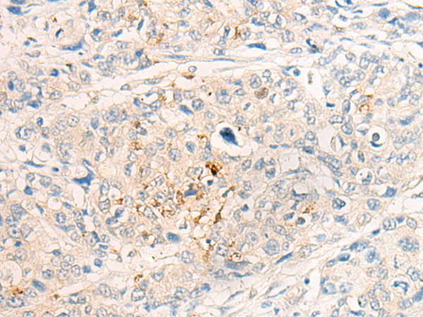 Rabbit Polyclonal Antibody to IL20RB