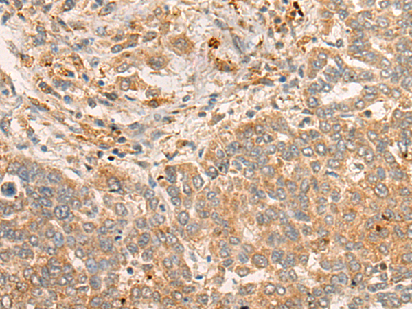 Rabbit Polyclonal Antibody to FBXO32