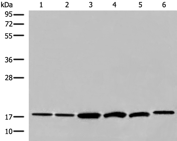 Rabbit Polyclonal Antibody to DENR