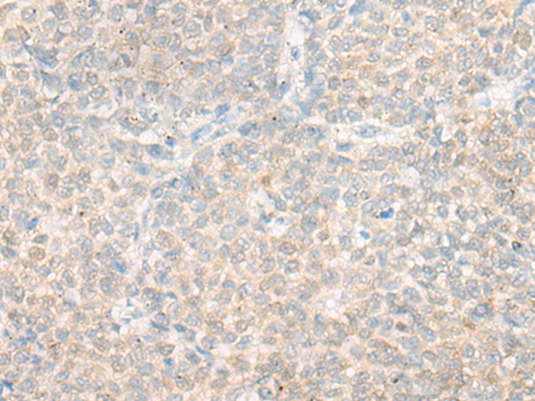 Rabbit Polyclonal Antibody to DHRS4
