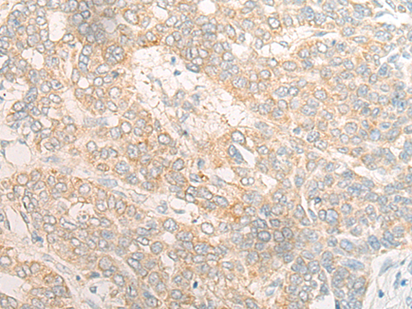 Rabbit Polyclonal Antibody to DOC2B