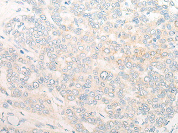 Rabbit Polyclonal Antibody to RNF19A