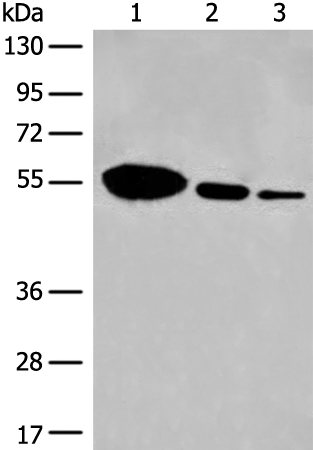 Rabbit Polyclonal Antibody to DYNC1LI2