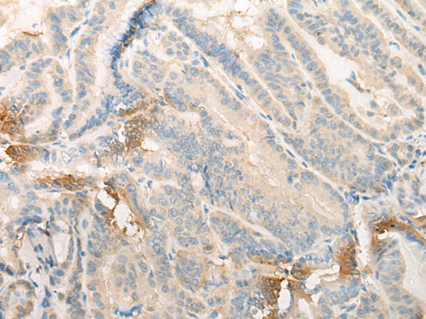 Rabbit Polyclonal Antibody to EFCAB5