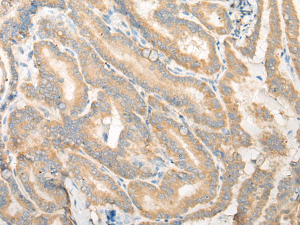 Rabbit Polyclonal Antibody to EPB41L4B