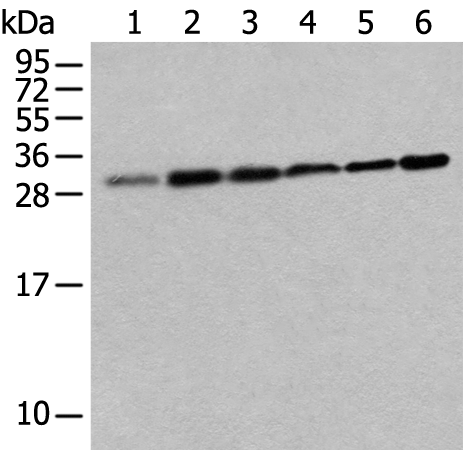 Rabbit Polyclonal Antibody to EIF3J