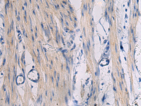 Rabbit Polyclonal Antibody to KLF1