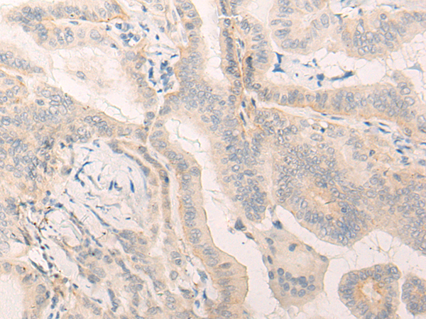 Rabbit Polyclonal Antibody to ELANE