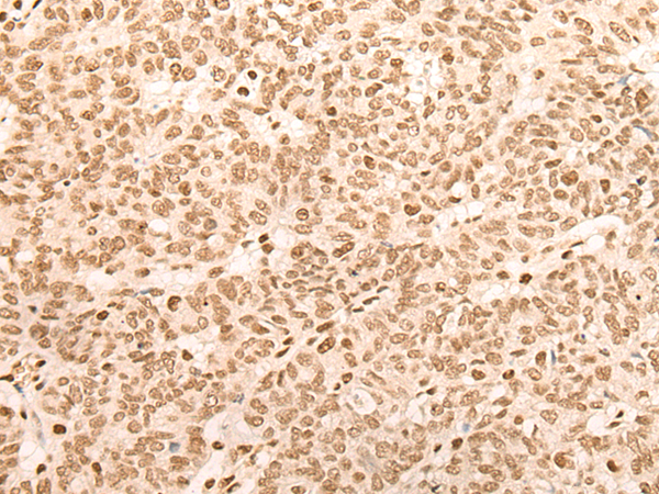 Rabbit Polyclonal Antibody to CELF2