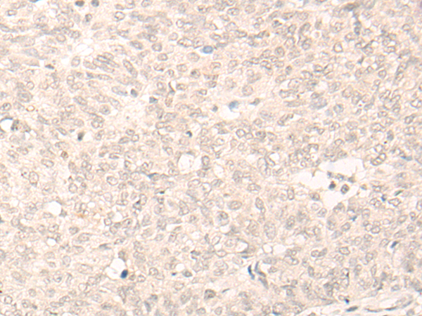 Rabbit Polyclonal Antibody to ELL2