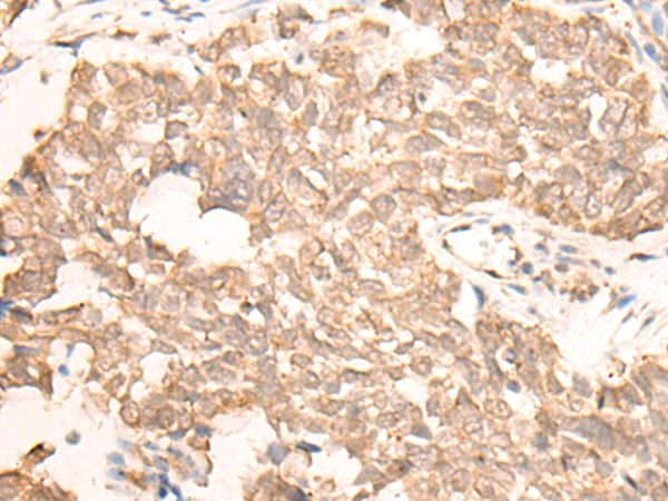 Rabbit Polyclonal Antibody to EMSY