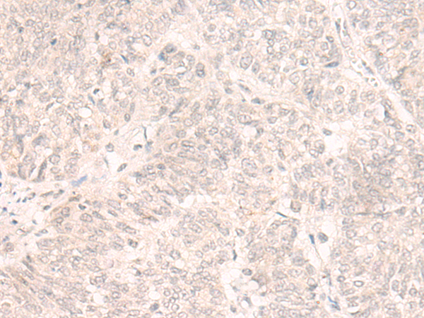 Rabbit Polyclonal Antibody to EMX2