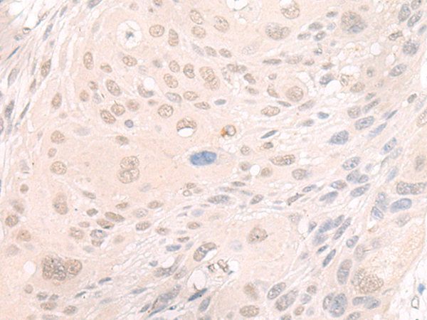 Rabbit Polyclonal Antibody to EN1