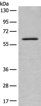 Rabbit Polyclonal Antibody to ENO4