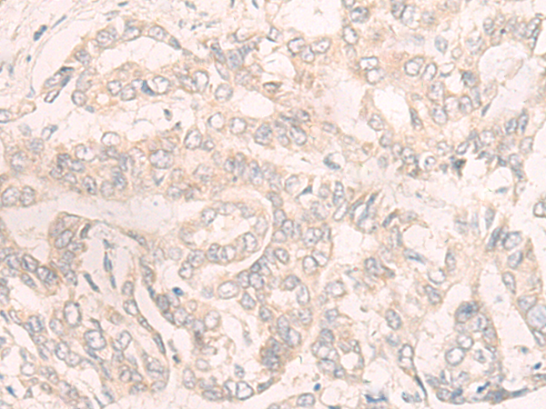 Rabbit Polyclonal Antibody to ENOSF1