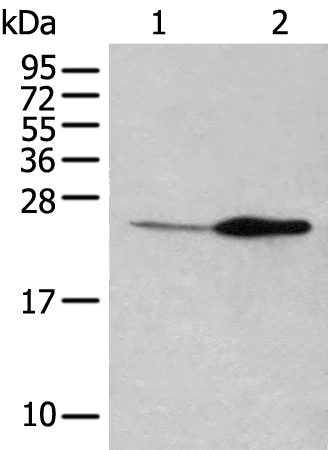 Rabbit Polyclonal Antibody to IL11