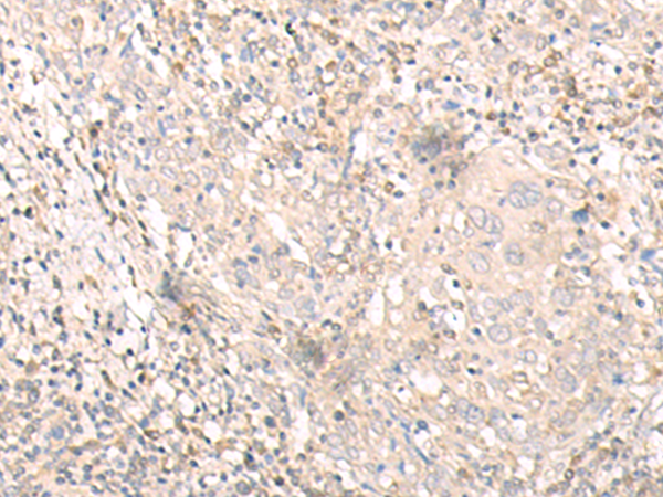Rabbit Polyclonal Antibody to IL24