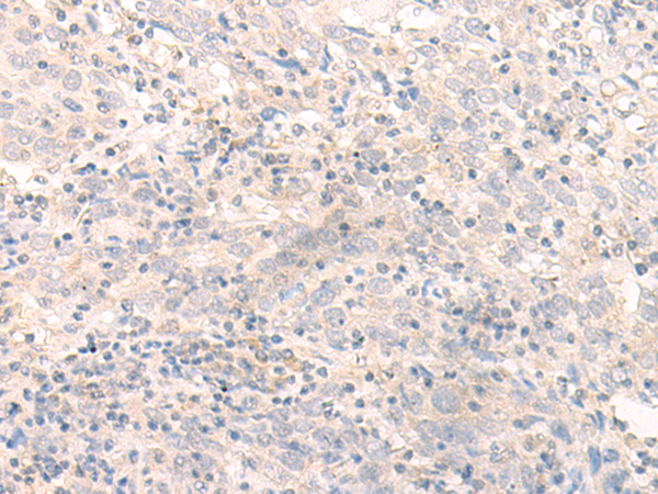 Rabbit Polyclonal Antibody to IL26