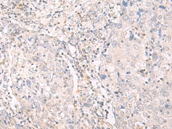 Rabbit Polyclonal Antibody to IL12B