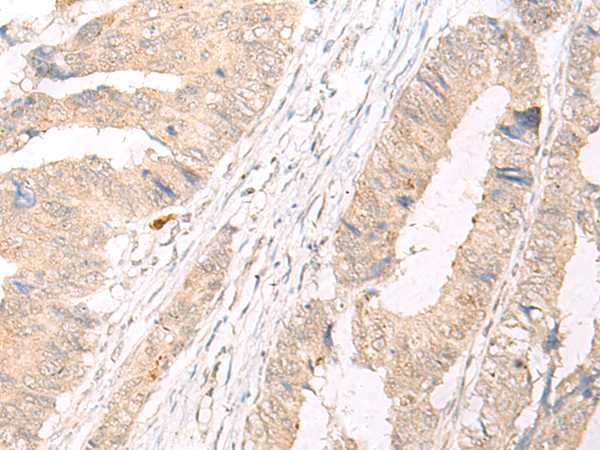 Rabbit Polyclonal Antibody to HLA-A/B/C