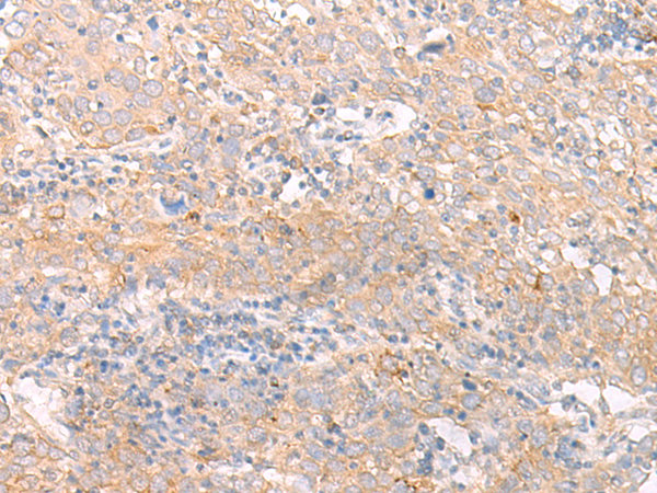 Rabbit Polyclonal Antibody to IFNL1