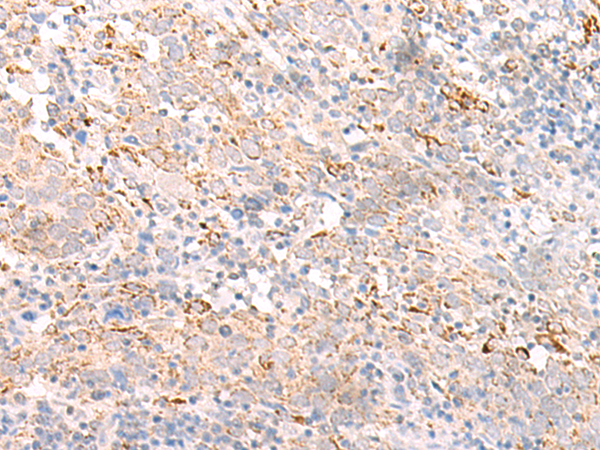 Rabbit Polyclonal Antibody to IFNL2