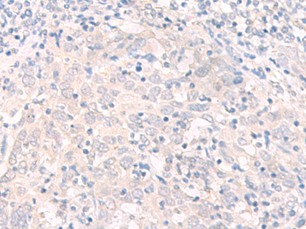 Rabbit Polyclonal Antibody to IL17B