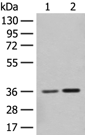 Rabbit Polyclonal Antibody to SLC25A27