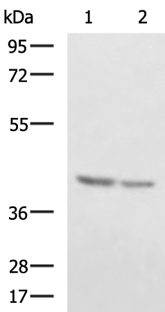 Rabbit Polyclonal Antibody to FBXO32